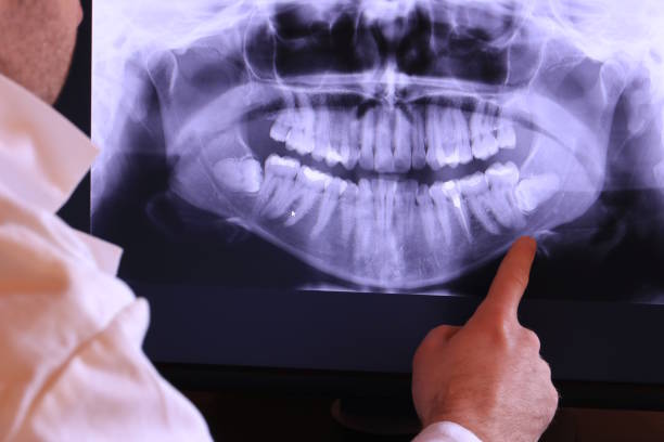 Best Weekend Emergency Dentist in Bellevue, IL