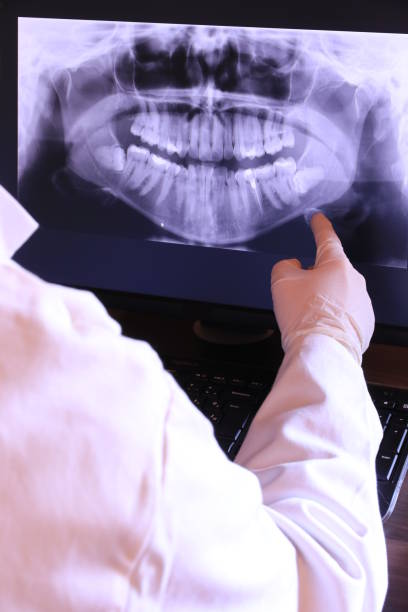 Best Emergency Treatment for Toothache in Bellevue, IL