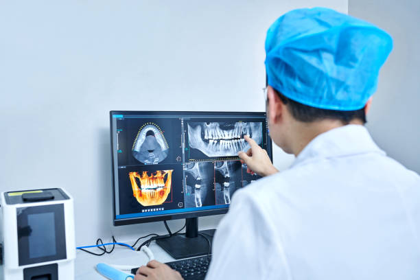 Best Emergency Root Canal Treatment in Bellevue, IL